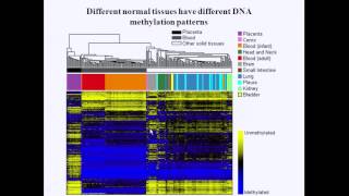 Environmental exposures childhood leukemia amp the role of DNA methylation [upl. by Ellehcen]