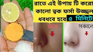 5 মিনিটে ফর্সা হবার সহজ উপায়forsa hobar sohoj upayবেসন দিয়ে ফেসিয়ালGolw Facial [upl. by Renita646]