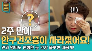 Full 2주 만에 안구 건조증이 사라졌어요ㅣ귀하신 몸ㅣ44화 눈이 아프고 뻑뻑하고 침침하다면 [upl. by Lani]