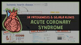 PATOGENESIS DAN GEJALA KLINIS SINDROM KORONER AKUT 1 ISCHEMIC HEART DISEASE [upl. by Ailasor]