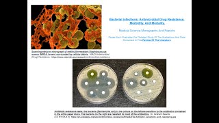 Infected By Bacteria Antimicrobial Drug Resistance Pathogenicity Morbidity And Mortality [upl. by Vasti]