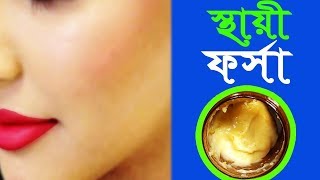 Bangla Rupchorcha মুখ ফর্সা করার উপায় Oily Skin Care Tips Bangla Tips For Fairness [upl. by Llerdnod]