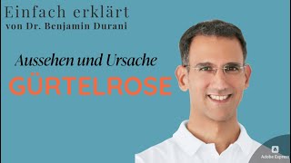 Gürtelrose  Aussehen und Ursachen  Einfach erklärt von Dr Durani Facharzt für Hautkrankheiten [upl. by Zeke752]