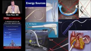 Surgical Treatment of Afib Ross Reul MD Sunday August 21 2016 [upl. by Aime641]