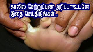 காலில் சேற்றுப்புண் அரிப்பாஉடனே இதை செய்திடுங்கள் [upl. by Inilam6]