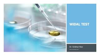 Widal test indications amp interpretations [upl. by Eldwon959]