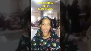 Hyperthyroidism With Exopthalamos video image for norcet [upl. by Ellenwahs]