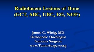 Orthopedic Oncology Course  Radiolucent Lesions of Bone GCT ABC UBC  Lecture 7 [upl. by Ashien]