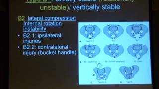 3 Classification of pelvic ring disruption Acharyria [upl. by Horsey]