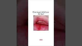 How to get rid of dry lips 🎀 fyp shorts viral viralshorts kpop bts aesthetic beauty [upl. by Ahsillek871]