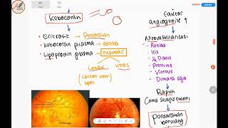 Retinopati Diabetikum Komplikasi DM  Patogenesis Jalur Poliol Jenis Diagnosis Tatalaksana [upl. by Asenej559]