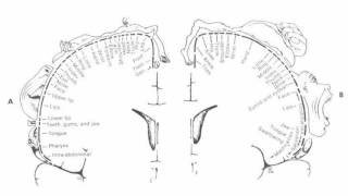 Difference Between Aphasia and Dysarthria [upl. by Ellehcar]