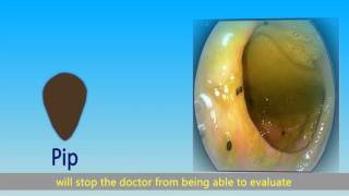 Preparation for colonoscopy [upl. by Nirre]