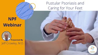 Pustular Psoriasis and Caring for Your Feet [upl. by Ydneh569]