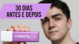 30 Dias Retinol Creamy  Antes e Depois SkinCare [upl. by Clarhe390]