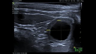 Maine Coon pregnancy scan  just under 3 weeks [upl. by Nea791]