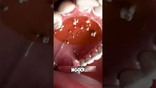 Hyperdontia bạn đã biết chưa dentist facts nhakhoa teeth [upl. by Hosbein59]