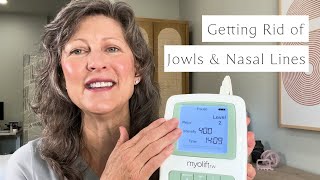 Getting Rid of Jowls and Nasal Lines with the Myolift Triwave [upl. by Ellimahs]