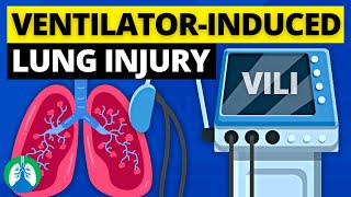 VentilatorInduced Lung Injury VILI  Quick Explainer Video [upl. by Edniya]