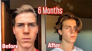 Mens hair growth time lapse 6 months  from shaved undercut [upl. by Hedvig]