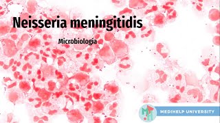 Neisseria Meningitidis  ¿Infección en tu cerebro [upl. by Hudgens]