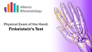 Rheumatology HAND exam Finkelsteins Test for DeQuervains Tenosynovitis [upl. by Oijile]