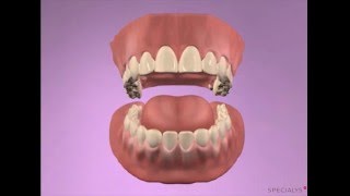 LEARN TO SUTURE THE EASY WAY  Surgical Technique  Interrupted Buccal Suturing  Dental  Medical [upl. by Barimah]