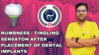 Dr Rudra Mohan  Neurosensory Disturbances After Dental Implant Placement  Numblness  Tingling [upl. by Bish]