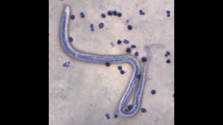 Microflilria MF of Wuchereria bancrofti under vital stained slide [upl. by Rudelson]