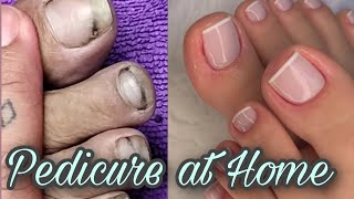 Pedicure at home Transformation from dirty to clean nails  Pedicure followingmydream [upl. by Orth755]