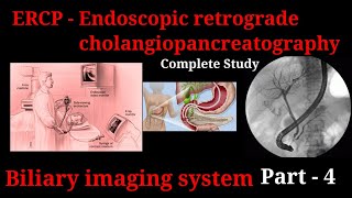 ERCP Procedure  Endoscopic retrograde cholangiopancreatography  biliary imaging system part 3 [upl. by Aritak]