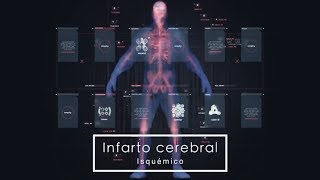 Infarto cerebral isquémico Síntomas y causas [upl. by Beaumont]