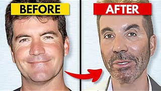 20 Celebrity Plastic Surgery Disasters [upl. by Sanjay]