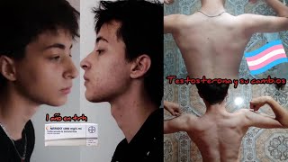 🏳️‍⚧️ Tratamiento hormonal en chicos trans  1 año en testosterona mi experiencia [upl. by Ariamat882]