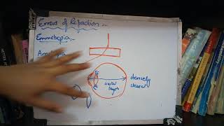 ERRORS OF REFRACTION general inroduction with important points [upl. by Kcirdek401]