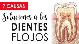 CUIDADO CON LOS DIENTES FLOJOS  CAUSAS Y SOLUCIONES 😱 [upl. by Ecilahs426]