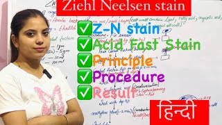 Ziehl Neelsen Stain ॥ ZN Stain ॥Acid Fast Staining ॥ZN Stain ॥Microbiology ॥principle ॥ procedure [upl. by Kauslick613]