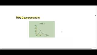 Tympanometry and Tympanogram [upl. by Corneille]