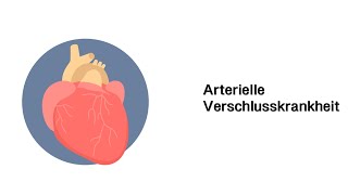 Arterielle Verschlusskrankheit AVK  Erkrankungen der Gefäße und des Kreislauf [upl. by Ping]