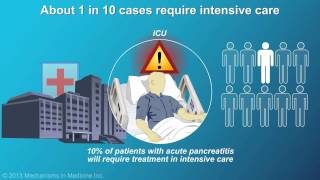 Management and Treatment of Acute Pancreatitis [upl. by Ailatan]