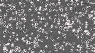 Timelapse of Neurite Outgrowth of Plated iCell® Neurons [upl. by Dnalrah]