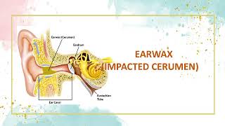 Impacted cerumen Definition of impacted cerumen  Causes of impacted cerumen Symptoms✨ [upl. by Enneire]