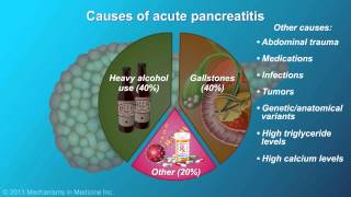 Acute Pancreatitis [upl. by Gefen]