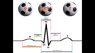 Heart class on conduction blocks [upl. by Ching]