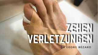 Zehenverletzungen Zehenbrüche und Dachziegelverband Tutorial [upl. by Ediva]