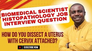 HOW DO YOU DISSECT A UTERUS WITH CERVIX ATTACHED [upl. by Heyes]