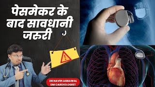 pacemakerAICD Device लगाने के बाद जरूर रखे ये सावधानियाquot Precautions Take After Getting a Pacemaker [upl. by Klute]