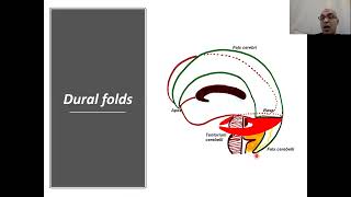 Cranial cavity surgical anatomy [upl. by Nya]