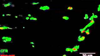 Wildtype PKCzeta expression does not effect myeloid cell migration to a tailfin wound [upl. by Nylissej]