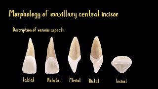 Morphology of maxillary central incisor [upl. by Llenrap]